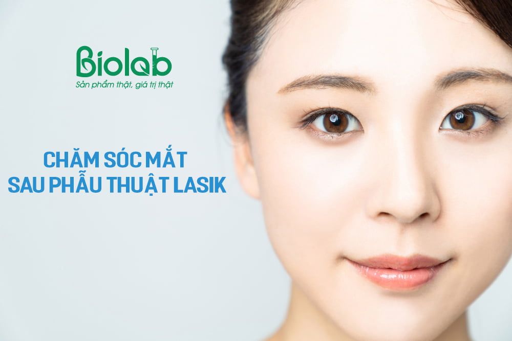 chăm sóc mắt sau phẫu thuật lasik an toàn